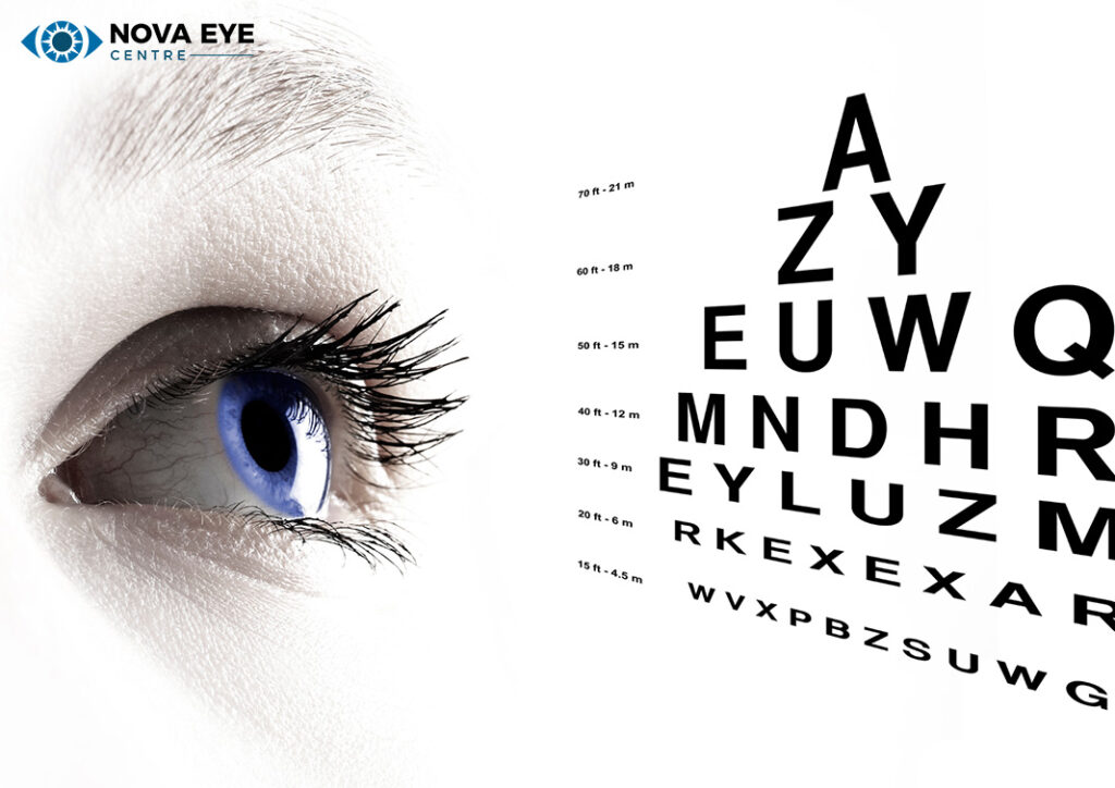 Close-up of an eye potentially with a cataract